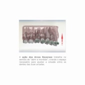 Arco NiTi Curva Reversa-SPEE Superelástico M Retangular - Morelli Arco NiTi Curva Reversa-SPEE Superelástico M Retangular - Morelli