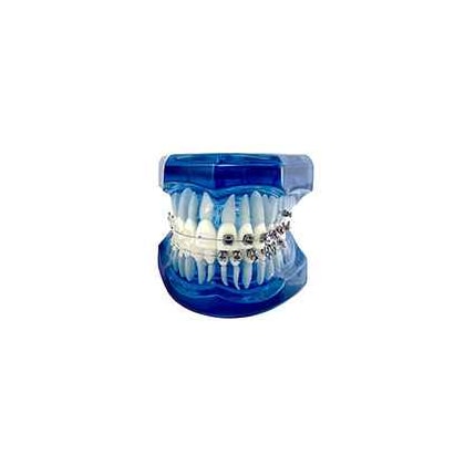 Manequim Didático Ortodôntico - 9199001 Manequim Didático Ortodôntico - 9199001